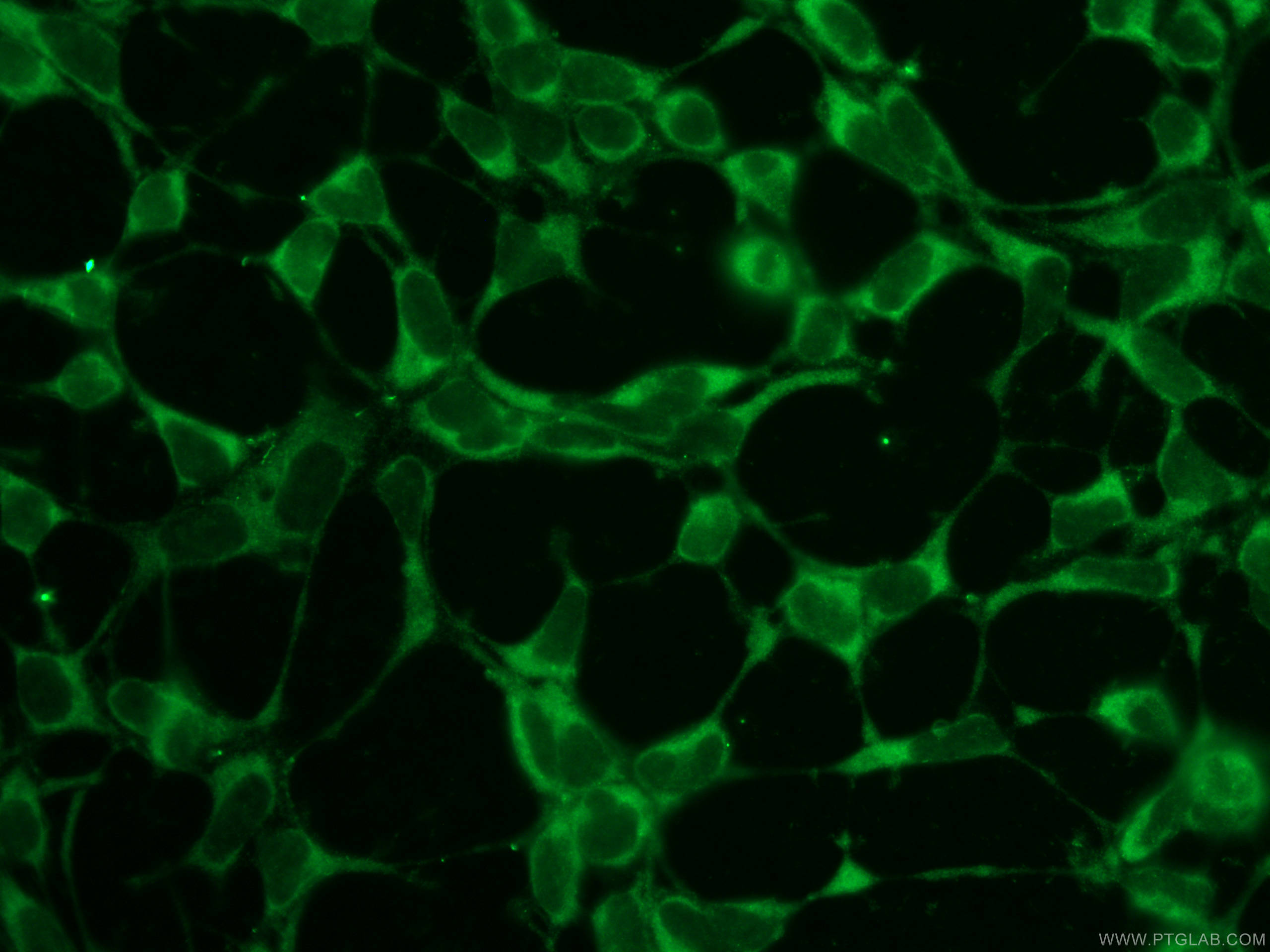 IF Staining of HEK-293 using 12704-1-AP