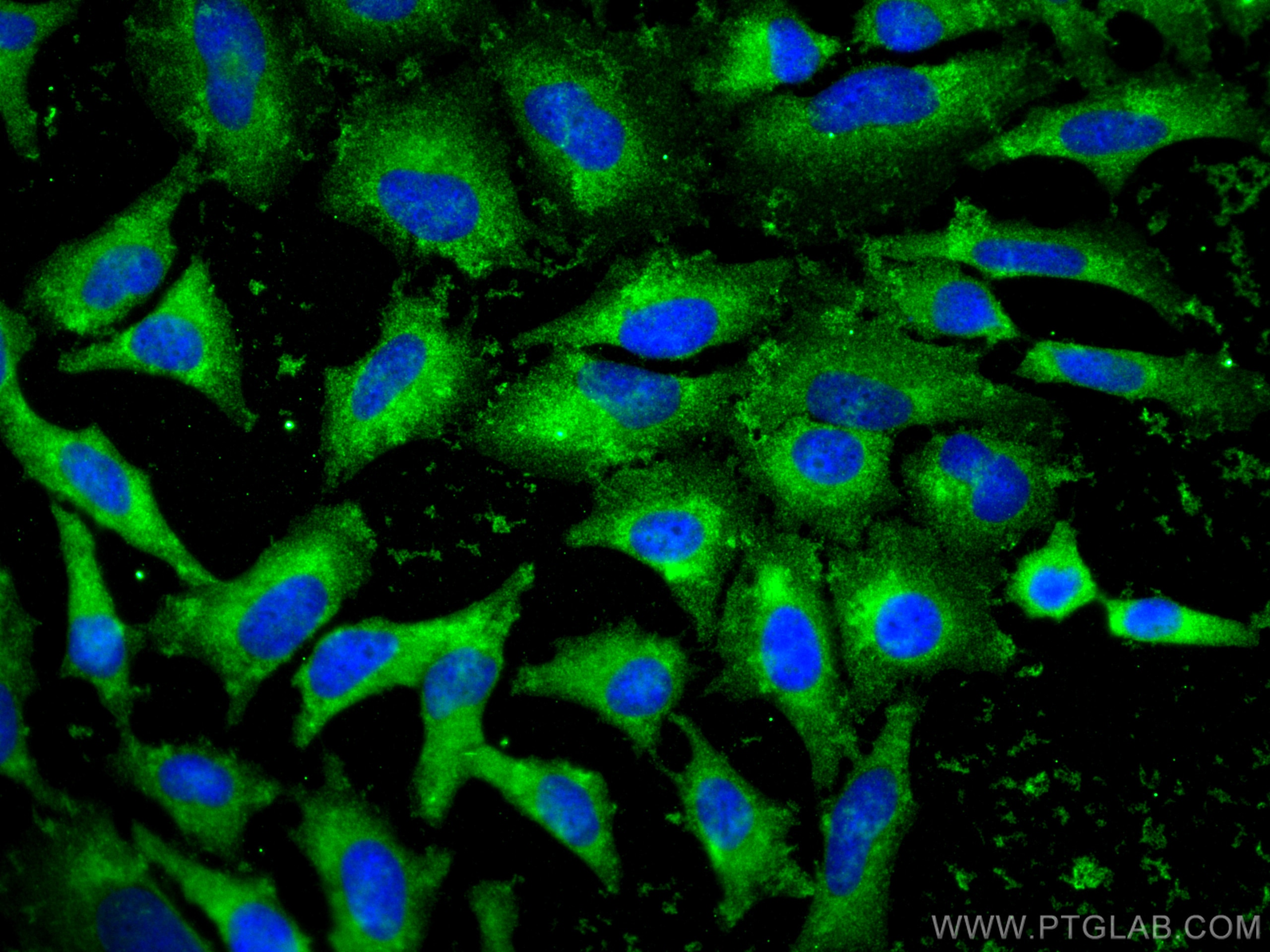 Immunofluorescence (IF) / fluorescent staining of HeLa cells using SNAP29 Polyclonal antibody (12704-1-AP)