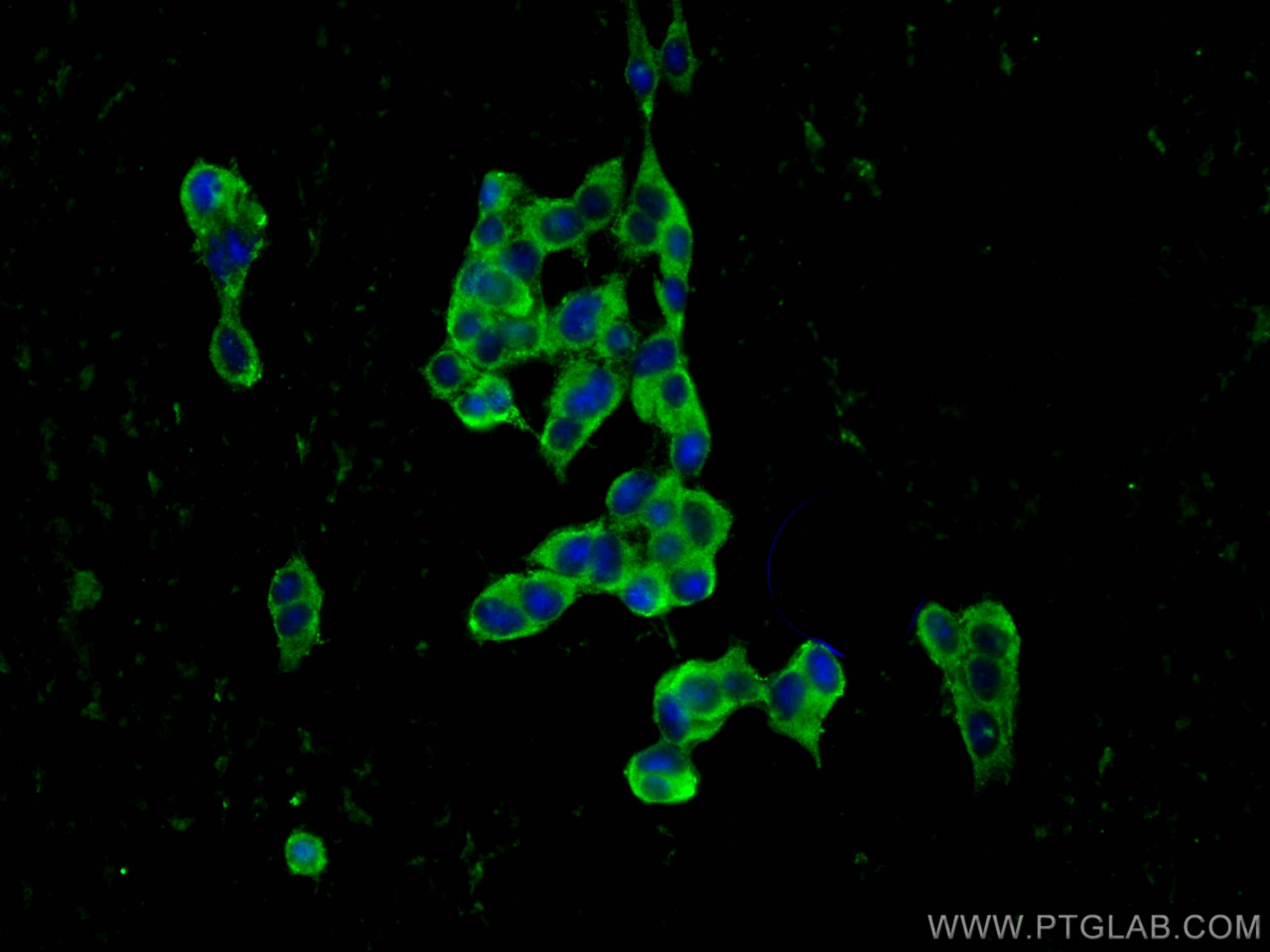 Immunofluorescence (IF) / fluorescent staining of PC-12 cells using SNAP29 Polyclonal antibody (12704-1-AP)