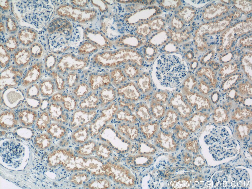 Immunohistochemistry (IHC) staining of human kidney tissue using SNAP29 Polyclonal antibody (12704-1-AP)
