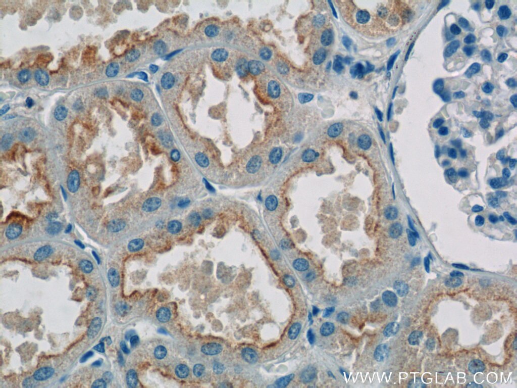 Immunohistochemistry (IHC) staining of human kidney tissue using SNAP29 Polyclonal antibody (12704-1-AP)