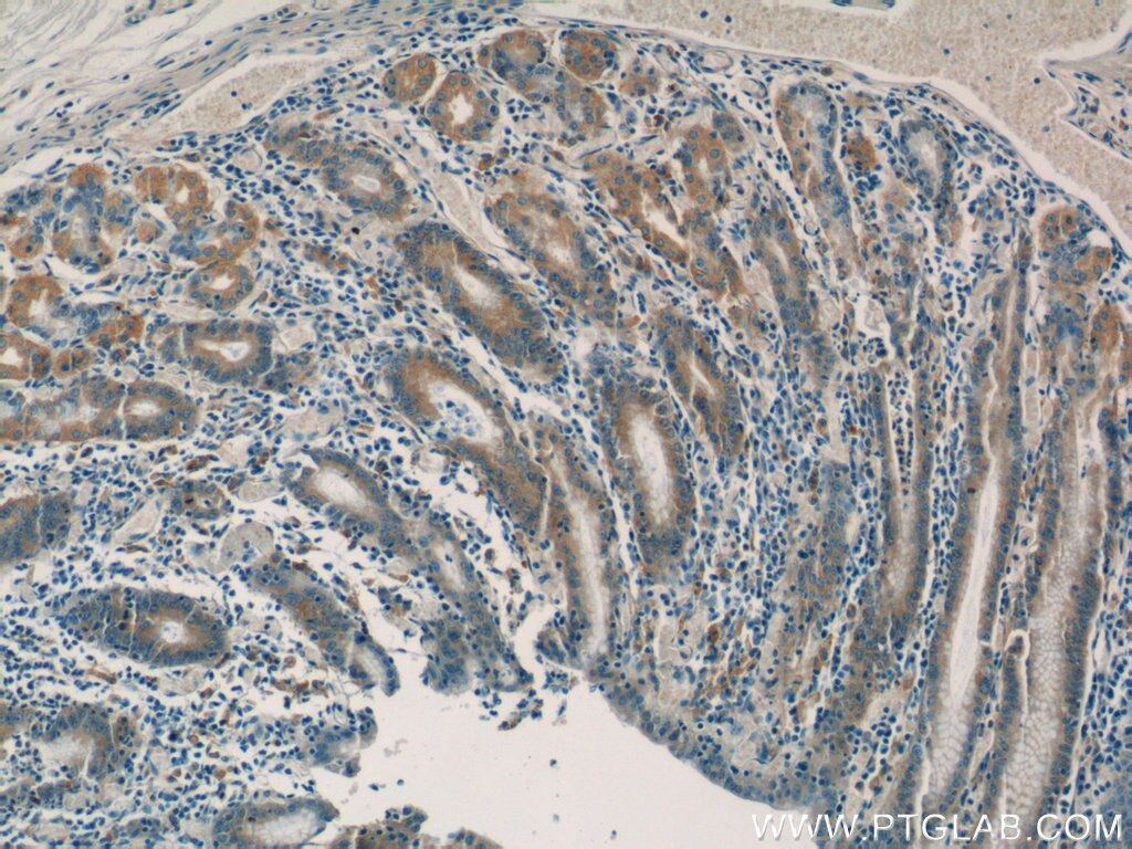 Immunohistochemistry (IHC) staining of human stomach tissue using SNAP29 Polyclonal antibody (12704-1-AP)