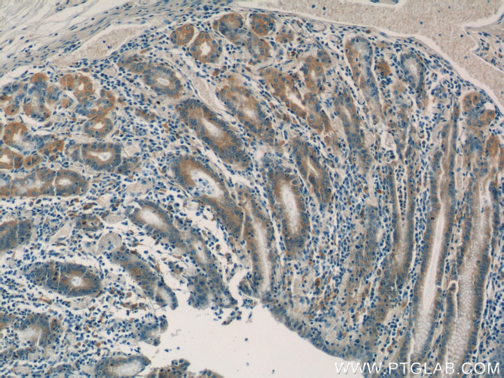 IHC staining of human stomach using 12704-1-AP