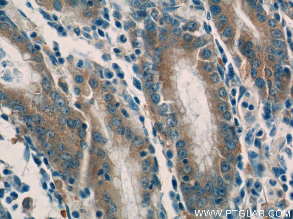 Immunohistochemistry (IHC) staining of human stomach tissue using SNAP29 Polyclonal antibody (12704-1-AP)