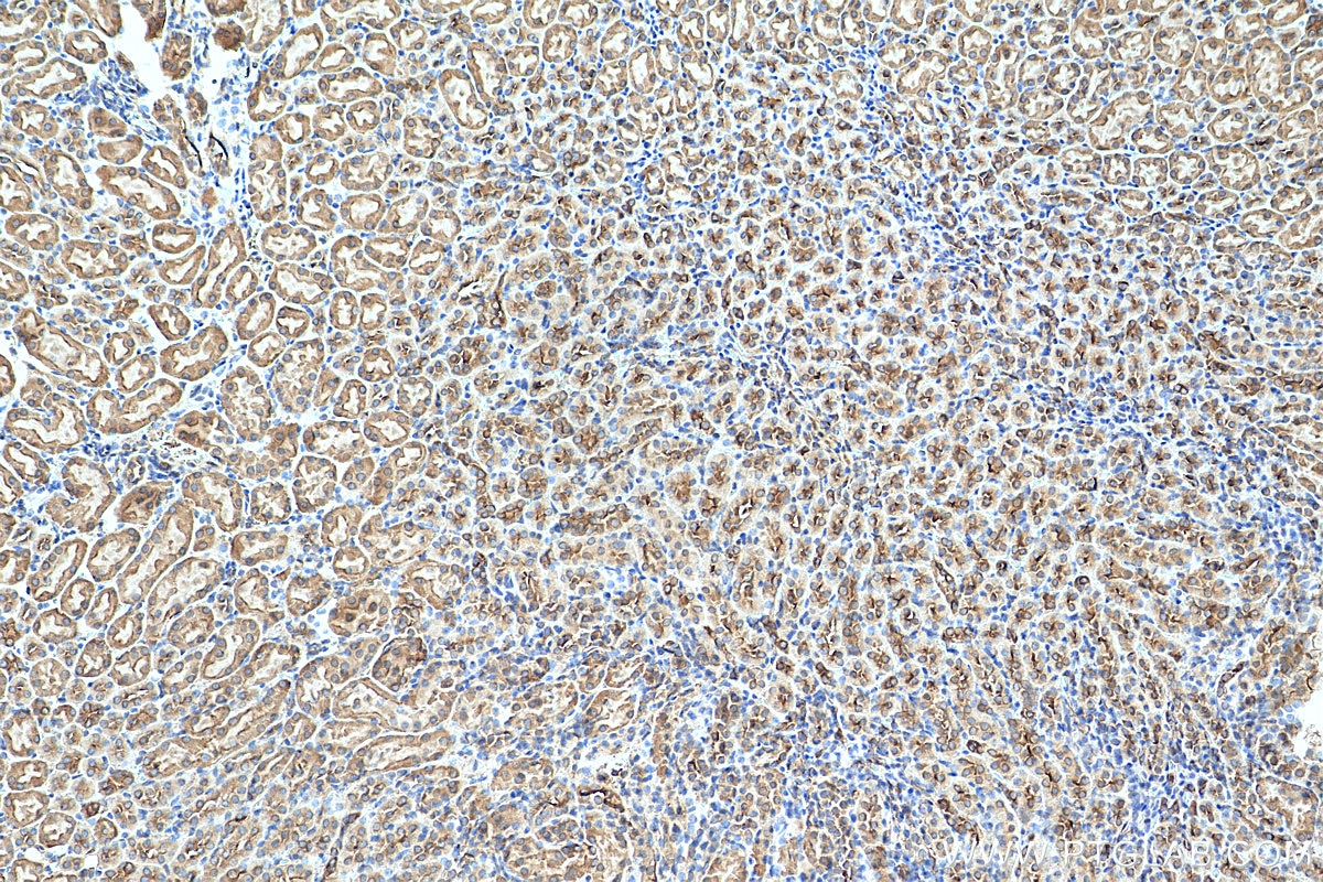 Immunohistochemistry (IHC) staining of mouse kidney tissue using SNAP29 Polyclonal antibody (12704-1-AP)