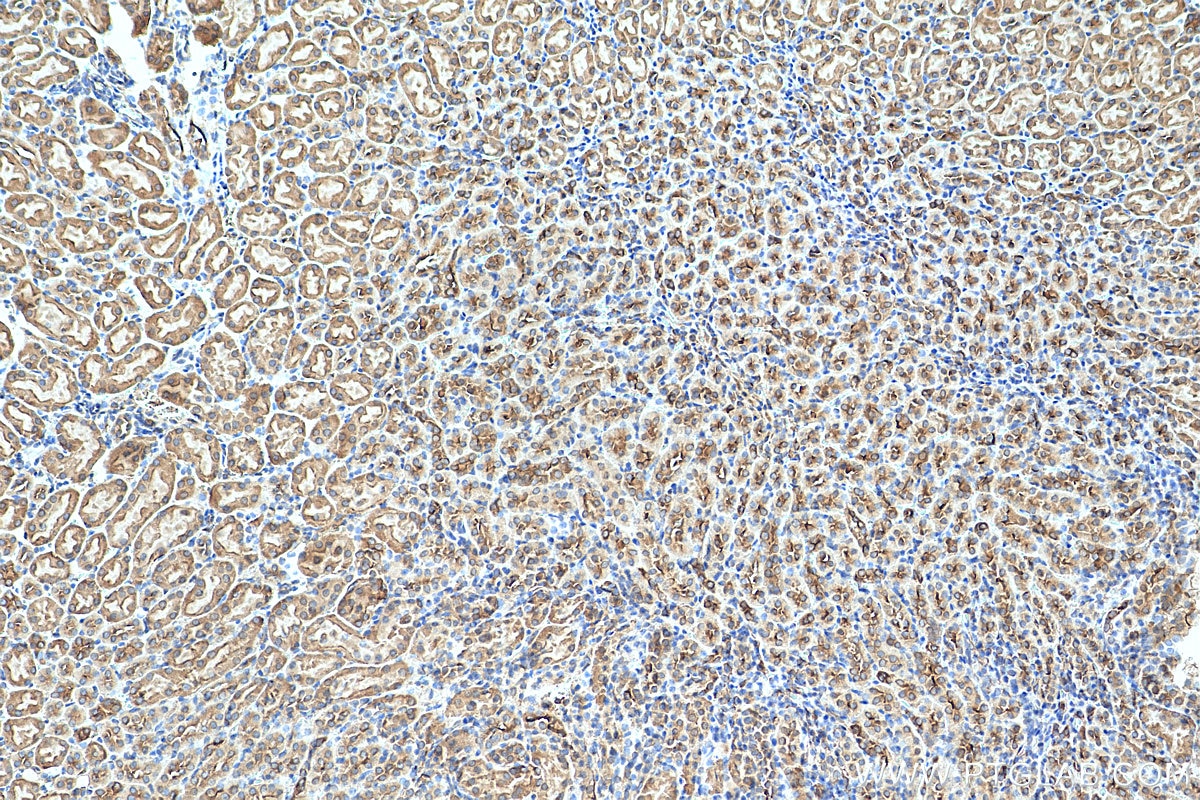 IHC staining of mouse kidney using 12704-1-AP