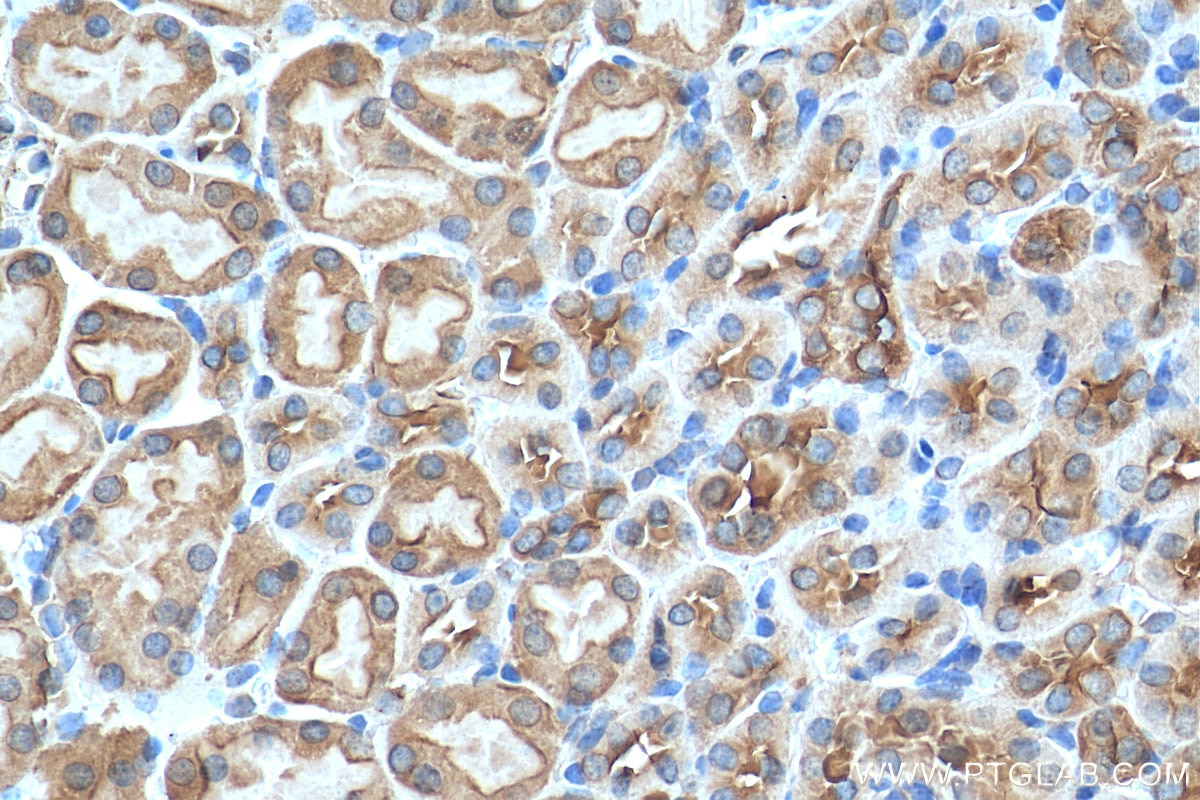 IHC staining of mouse kidney using 12704-1-AP