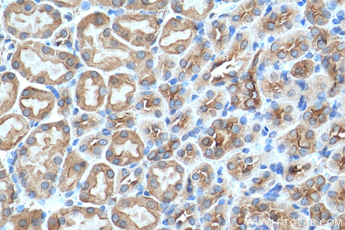 Immunohistochemistry (IHC) staining of mouse kidney tissue using SNAP29 Polyclonal antibody (12704-1-AP)