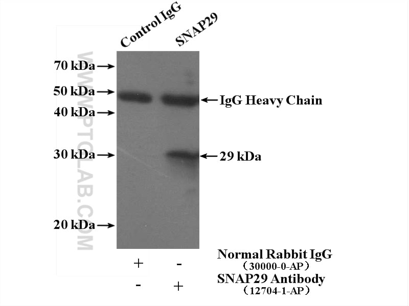 Immunoprecipitation (IP) experiment of Jurkat cells using SNAP29 Polyclonal antibody (12704-1-AP)