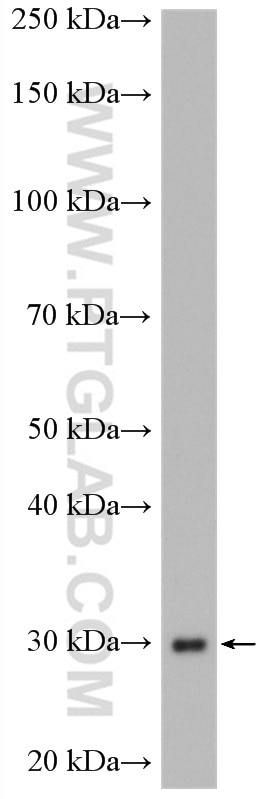 Western Blot (WB) analysis of K-562 cells using SNAP29 Polyclonal antibody (12704-1-AP)