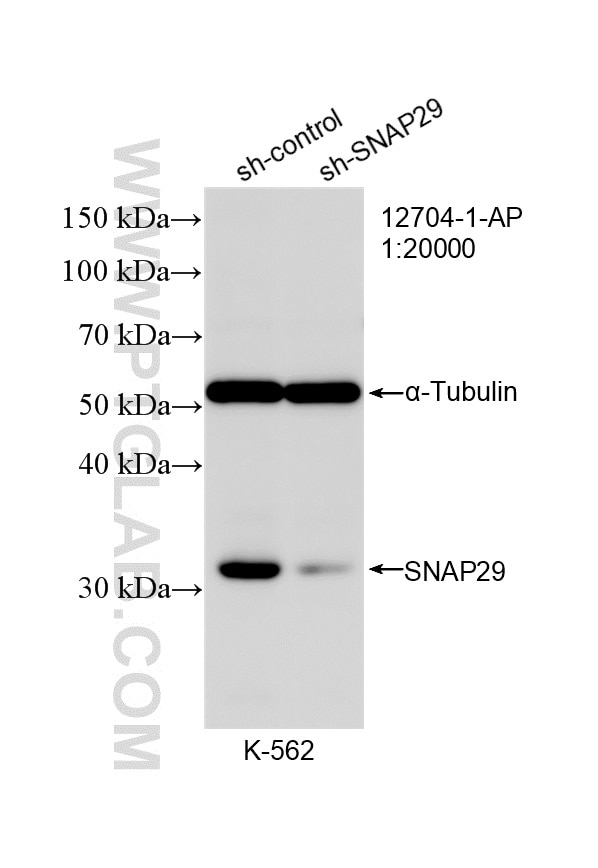 Western Blot (WB) analysis of K-562 cells using SNAP29 Polyclonal antibody (12704-1-AP)