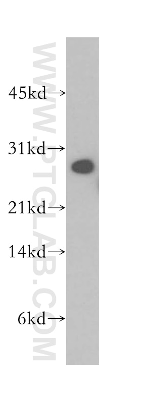 Western Blot (WB) analysis of human kidney tissue using SNAP29 Polyclonal antibody (12704-1-AP)
