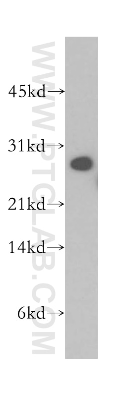 WB analysis of human kidney using 12704-1-AP