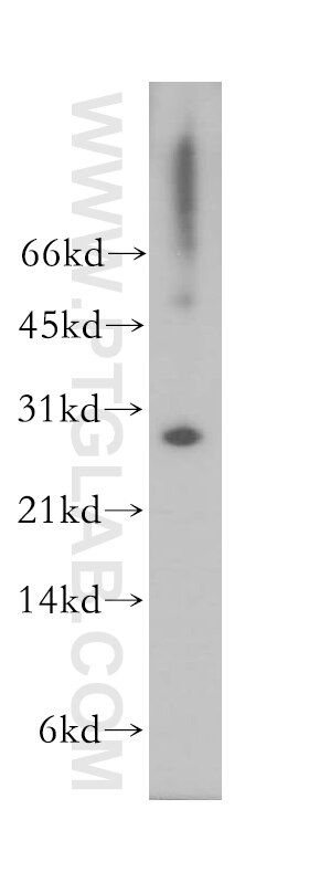 Western Blot (WB) analysis of human liver tissue using SNAP29 Polyclonal antibody (12704-1-AP)