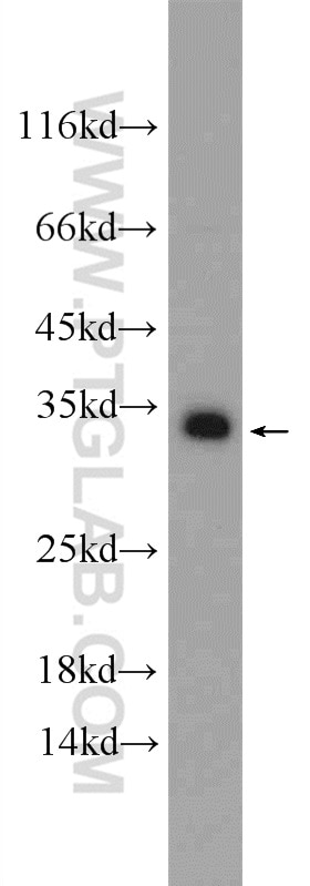 Western Blot (WB) analysis of HEK-293 cells using SNAP29 Polyclonal antibody (12704-1-AP)