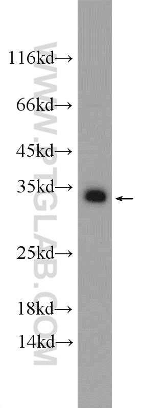 WB analysis of HEK-293 using 12704-1-AP