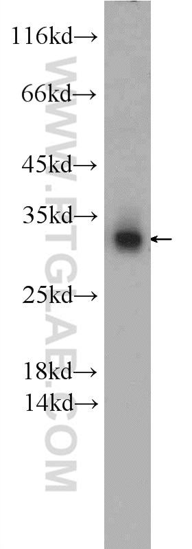 Western Blot (WB) analysis of Jurkat cells using SNAP29 Polyclonal antibody (12704-1-AP)