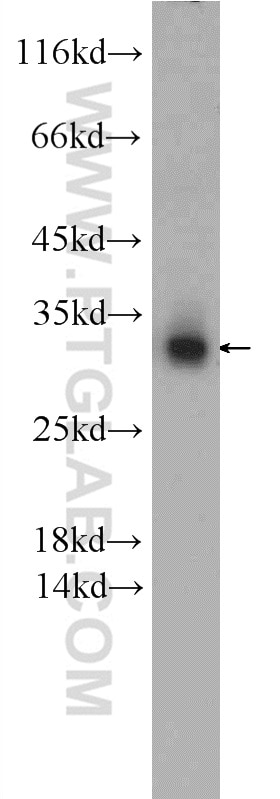 WB analysis of Jurkat using 12704-1-AP