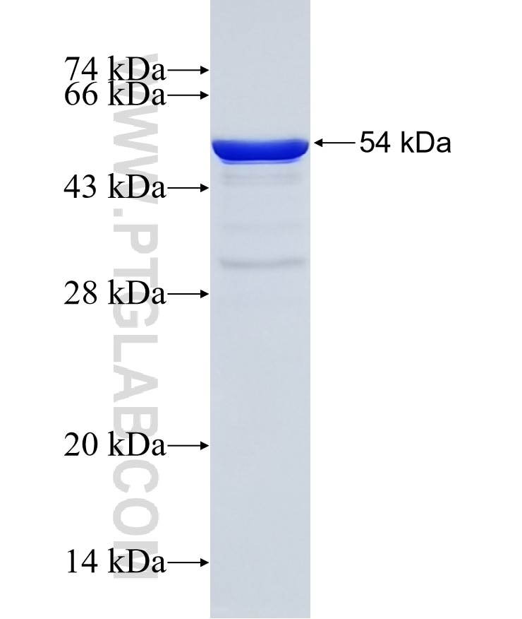 SNAP29 fusion protein Ag25067 SDS-PAGE