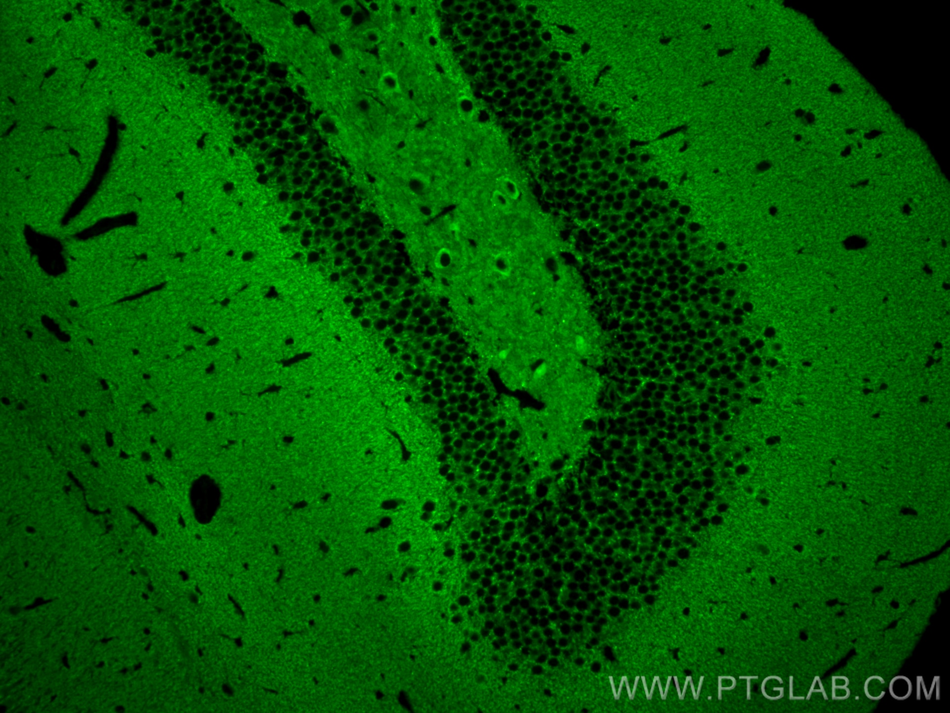 Immunofluorescence (IF) / fluorescent staining of mouse brain tissue using SNAP91 Polyclonal antibody (14093-1-AP)