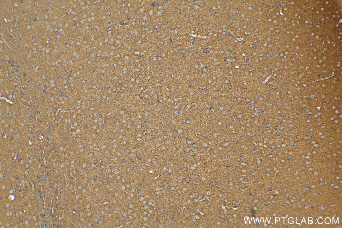 Immunohistochemistry (IHC) staining of mouse brain tissue using SNAP91 Polyclonal antibody (14093-1-AP)