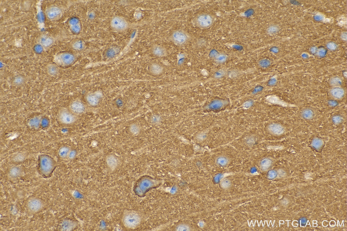 Immunohistochemistry (IHC) staining of mouse brain tissue using SNAP91 Polyclonal antibody (14093-1-AP)