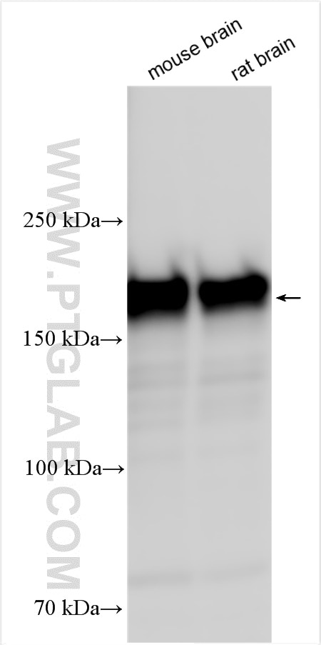 Western Blot (WB) analysis of various lysates using SNAP91 Polyclonal antibody (14093-1-AP)