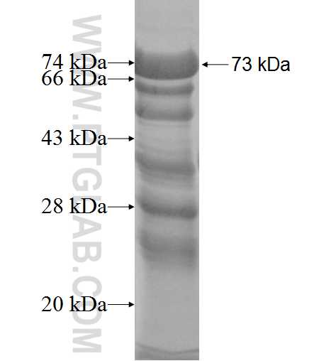 SNAP91 fusion protein Ag5224 SDS-PAGE
