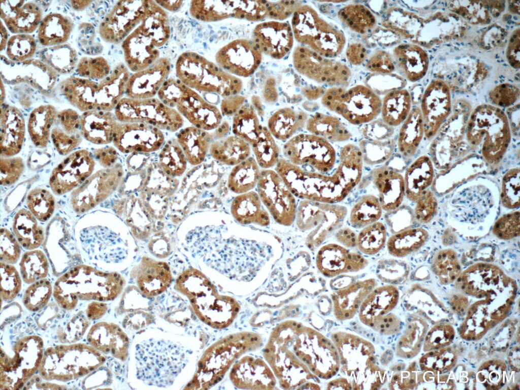Immunohistochemistry (IHC) staining of human kidney tissue using SNAPC5 Polyclonal antibody (17272-1-AP)