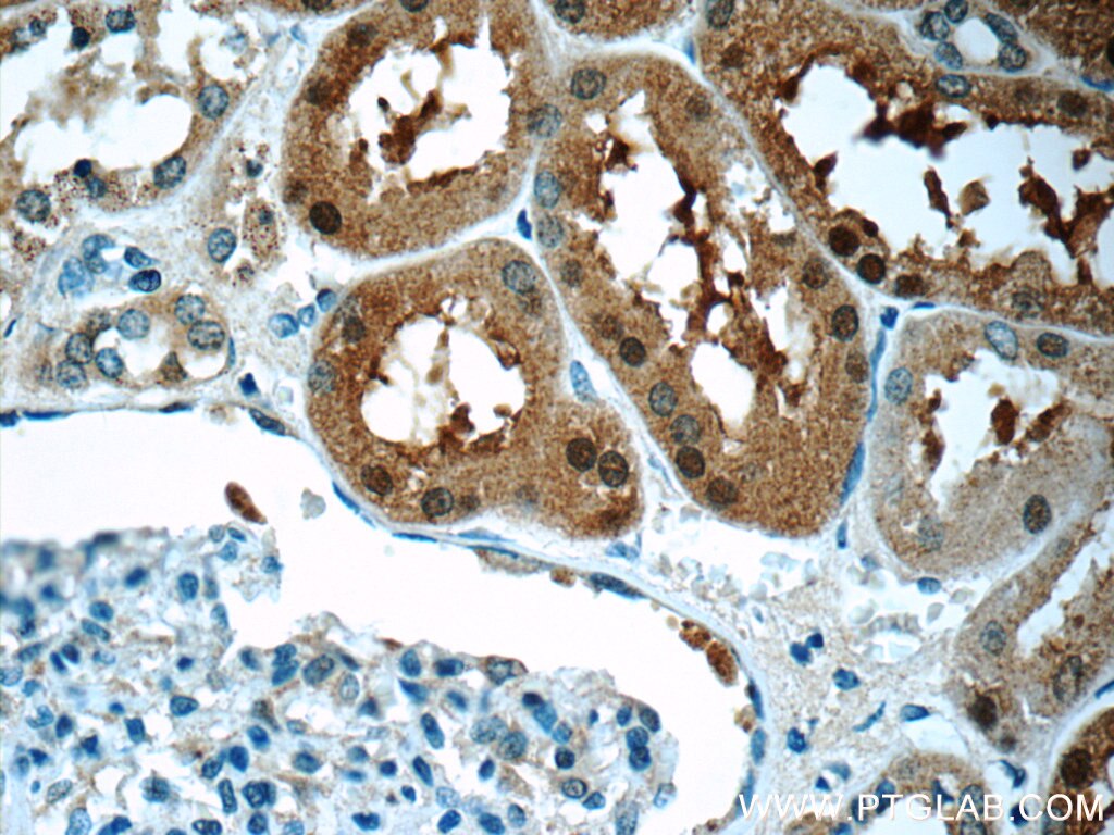 Immunohistochemistry (IHC) staining of human kidney tissue using SNAPC5 Polyclonal antibody (17272-1-AP)