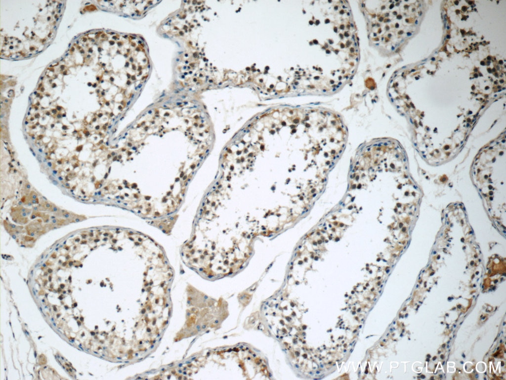 Immunohistochemistry (IHC) staining of human testis tissue using SNAPC5 Polyclonal antibody (17272-1-AP)