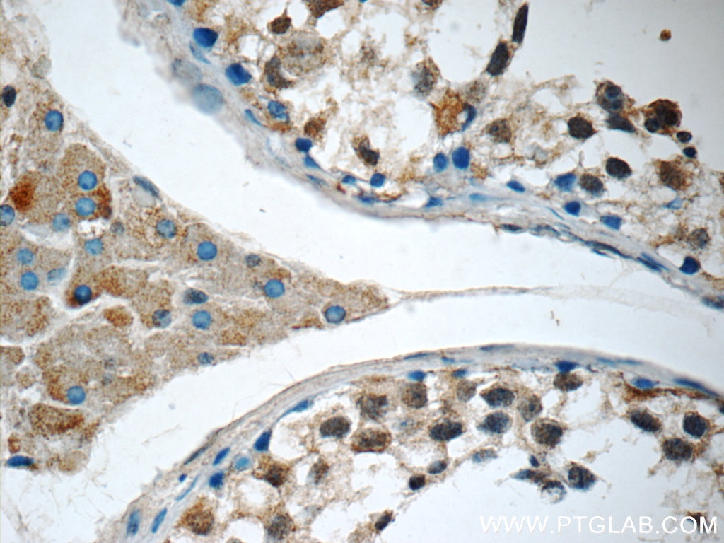 Immunohistochemistry (IHC) staining of human testis tissue using SNAPC5 Polyclonal antibody (17272-1-AP)