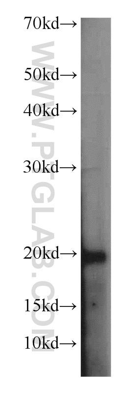 Western Blot (WB) analysis of HeLa cells using SNAPC5 Polyclonal antibody (17272-1-AP)