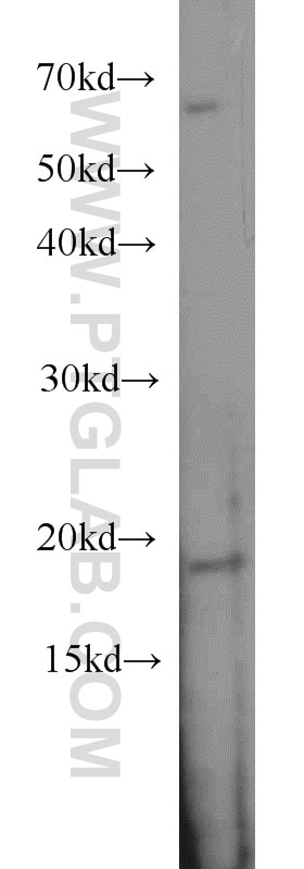 Western Blot (WB) analysis of HeLa cells using SNAPC5 Polyclonal antibody (17272-1-AP)