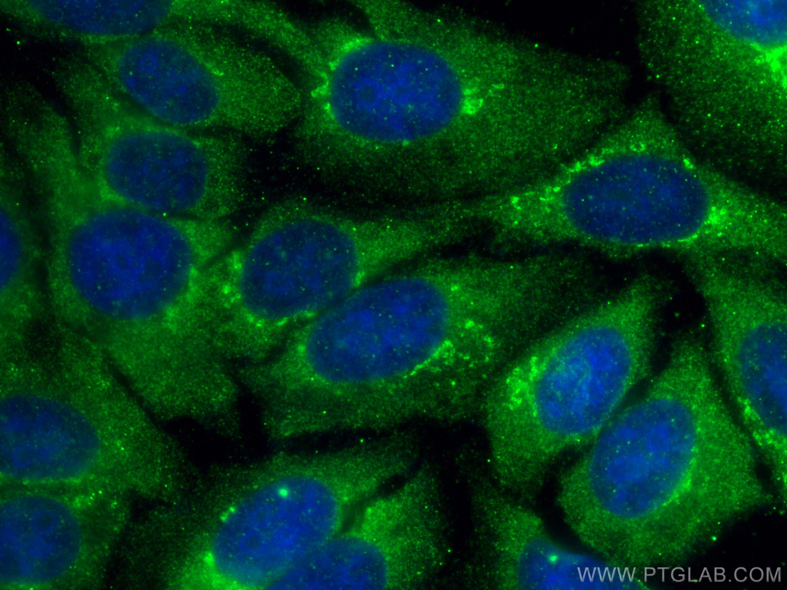 Immunofluorescence (IF) / fluorescent staining of HepG2 cells using SNAPIN Polyclonal antibody (10055-1-AP)