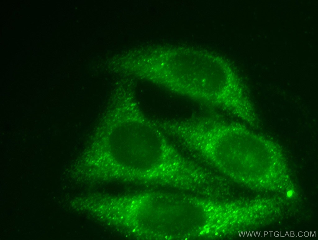 SNAPIN Polyclonal antibody