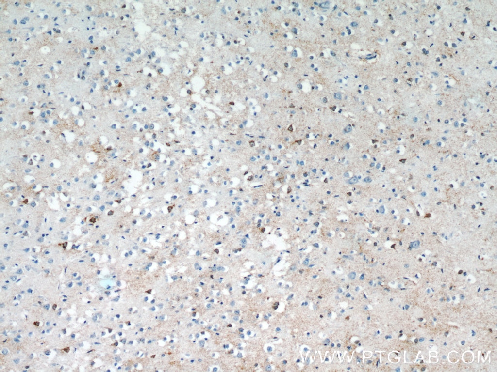 Immunohistochemistry (IHC) staining of human brain tissue using SNAPIN Polyclonal antibody (10055-1-AP)