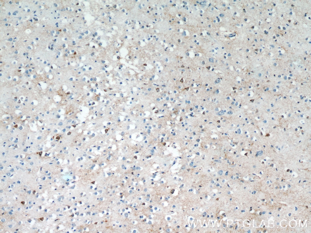 Immunohistochemistry (IHC) staining of human brain tissue using SNAPIN Polyclonal antibody (10055-1-AP)