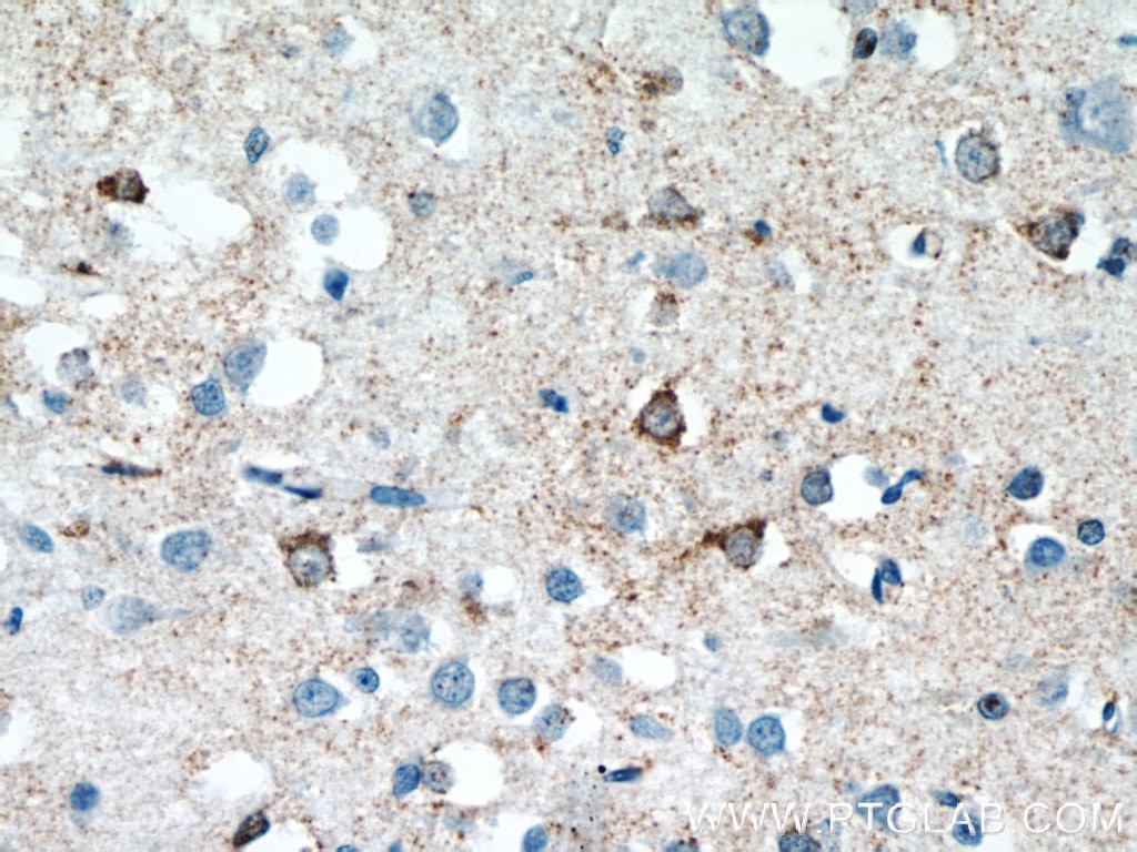 IHC staining of human brain using 10055-1-AP