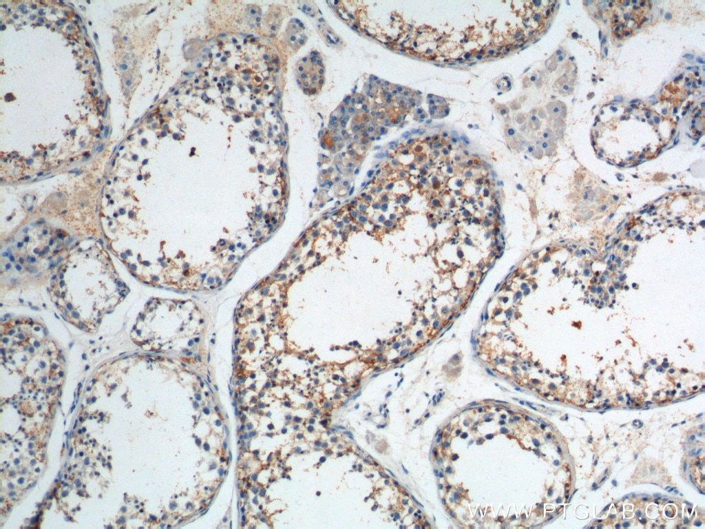 Immunohistochemistry (IHC) staining of human testis tissue using SNAPIN Polyclonal antibody (10055-1-AP)