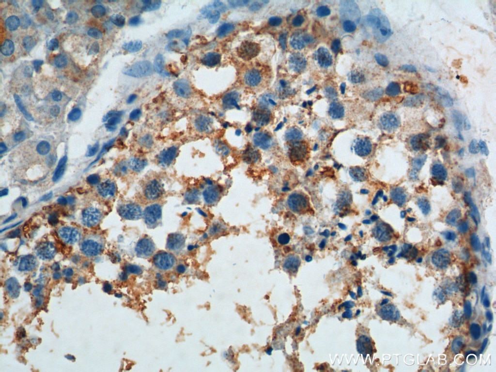 Immunohistochemistry (IHC) staining of human testis tissue using SNAPIN Polyclonal antibody (10055-1-AP)