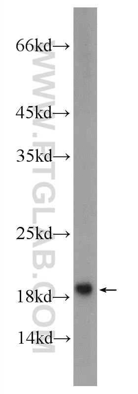 Western Blot (WB) analysis of rat brain tissue using SNAPIN Polyclonal antibody (10055-1-AP)