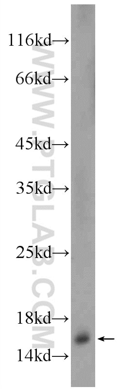 Western Blot (WB) analysis of HEK-293 cells using SNAPIN Polyclonal antibody (10055-1-AP)