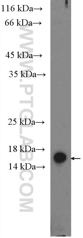 Western Blot (WB) analysis of A375 cells using SNAPIN Polyclonal antibody (10055-1-AP)