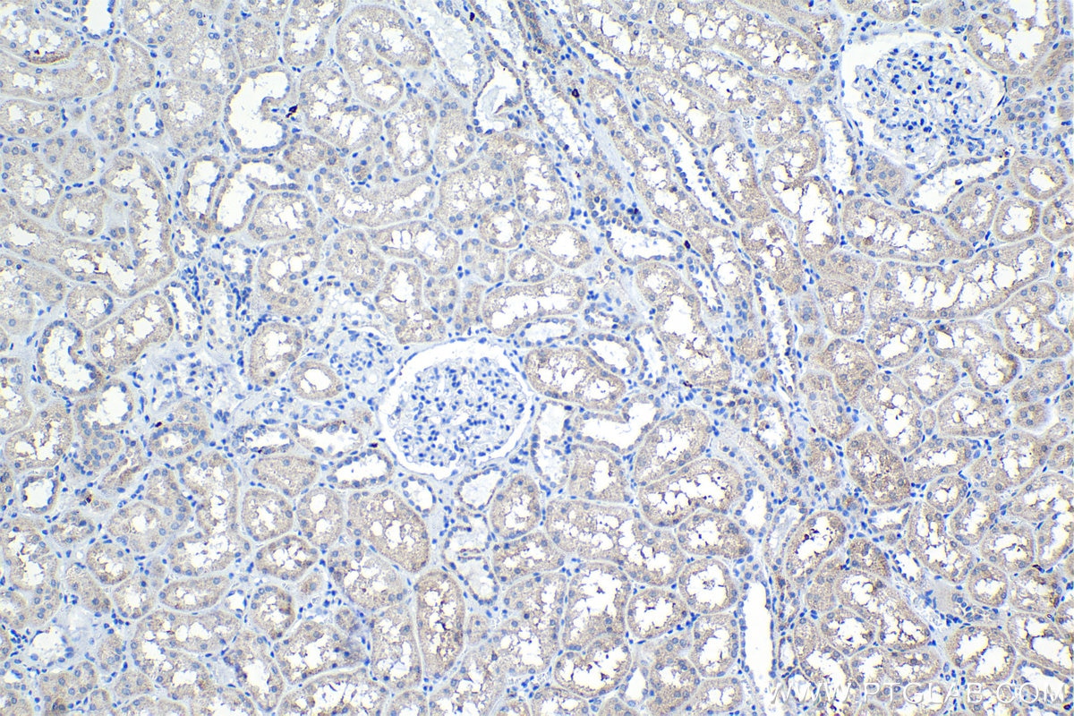 Immunohistochemistry (IHC) staining of human kidney tissue using SNAT2 Polyclonal antibody (25928-1-AP)