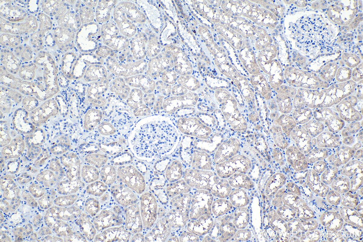 Immunohistochemistry (IHC) staining of human kidney tissue using SNAT2 Polyclonal antibody (25928-1-AP)