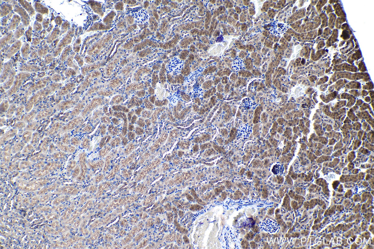 Immunohistochemistry (IHC) staining of mouse kidney tissue using SNAT2 Polyclonal antibody (25928-1-AP)