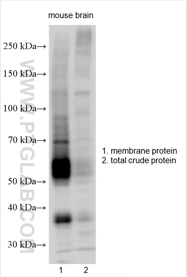 Western Blot (WB) analysis of various lysates using SNAT2 Polyclonal antibody (25928-1-AP)
