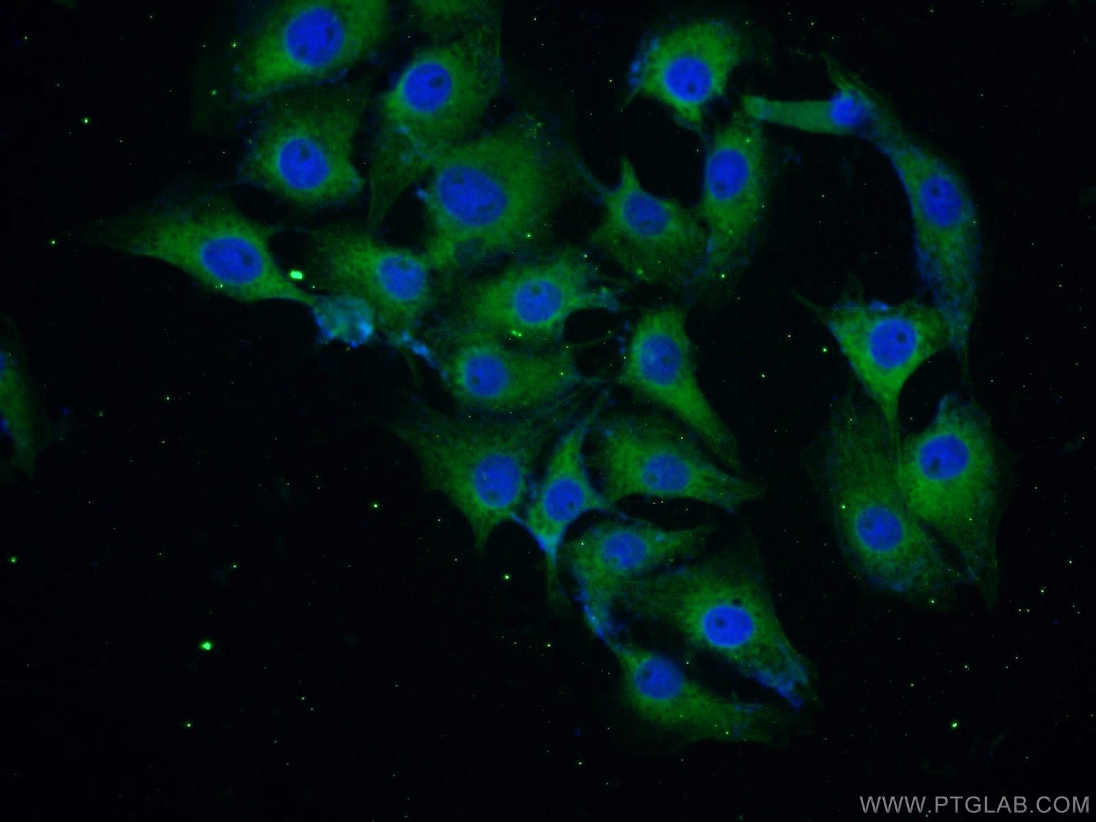 Immunofluorescence (IF) / fluorescent staining of SH-SY5Y cells using Alpha Synuclein Polyclonal antibody (10842-1-AP)