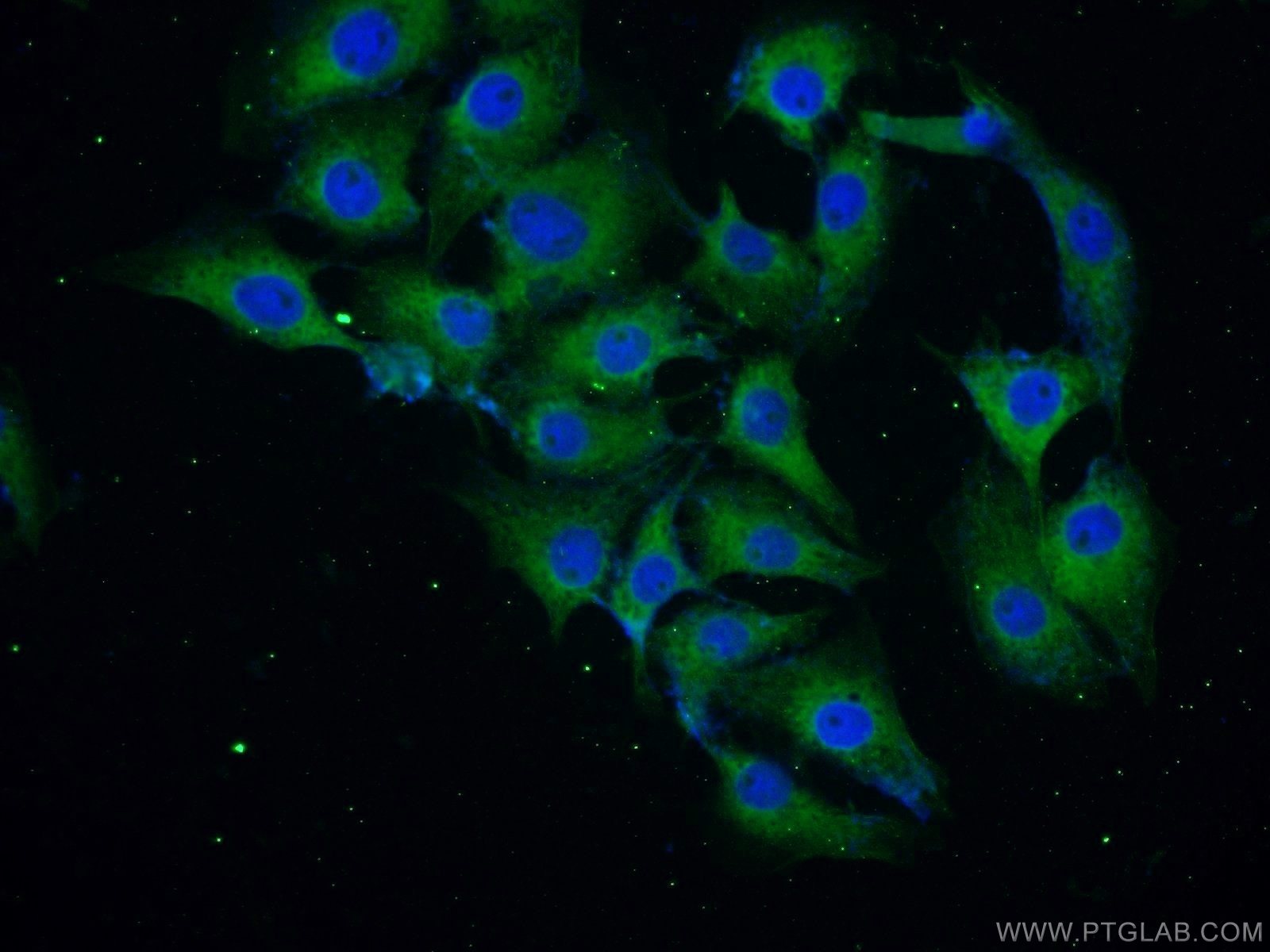 IF Staining of SH-SY5Y using 10842-1-AP